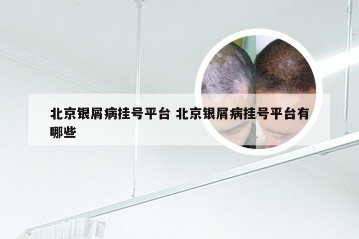 北京银屑病挂号平台 北京银屑病挂号平台有哪些