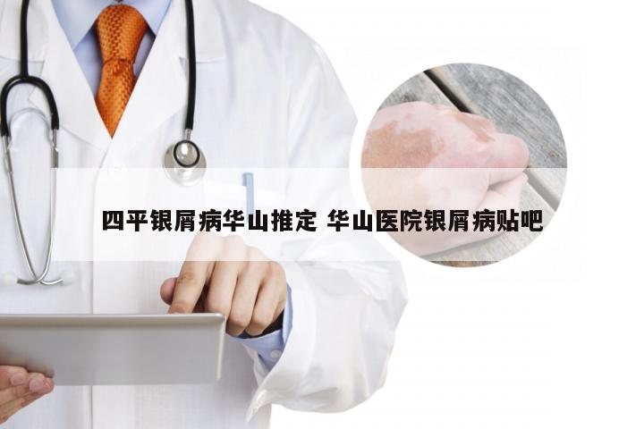四平银屑病华山推定 华山医院银屑病贴吧