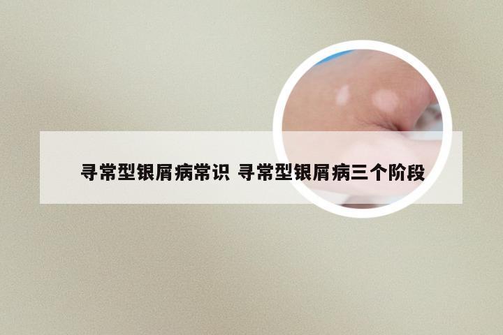寻常型银屑病常识 寻常型银屑病三个阶段