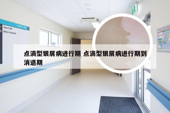 点滴型银屑病进行期 点滴型银屑病进行期到消退期