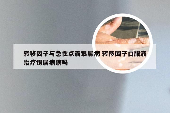 转移因子与急性点滴银屑病 转移因子口服液治疗银屑病病吗
