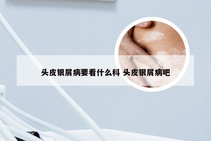 头皮银屑病要看什么科 头皮银屑病吧