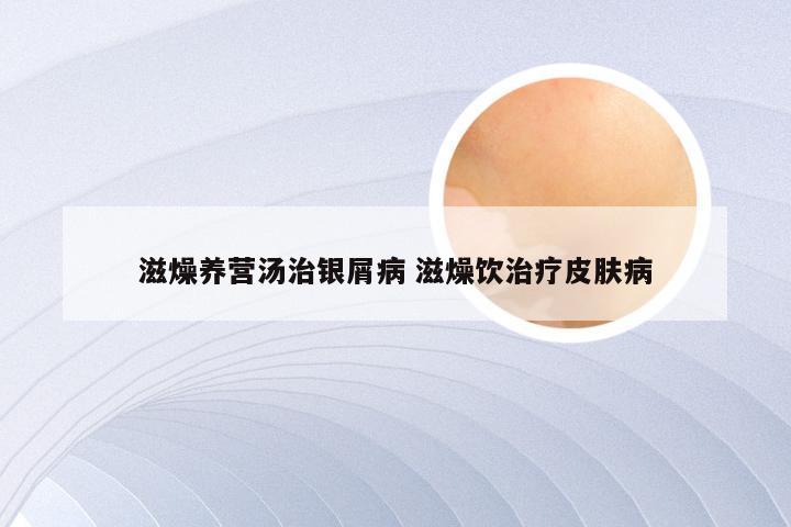 滋燥养营汤治银屑病 滋燥饮治疗皮肤病