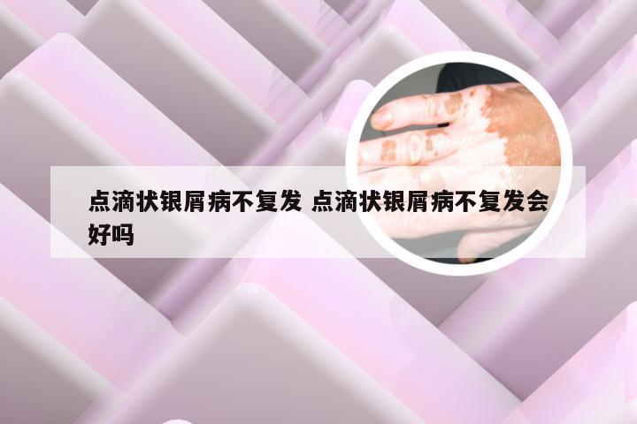 点滴状银屑病不复发 点滴状银屑病不复发会好吗