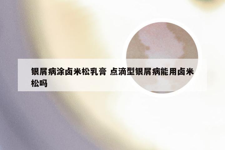 银屑病涂卤米松乳膏 点滴型银屑病能用卤米松吗