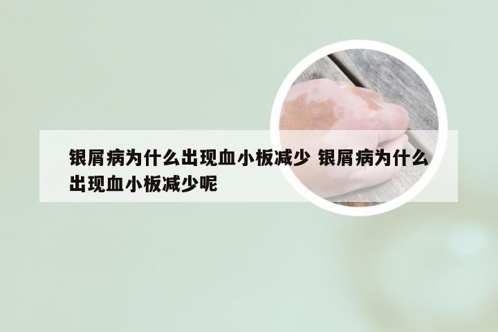 银屑病为什么出现血小板减少 银屑病为什么出现血小板减少呢