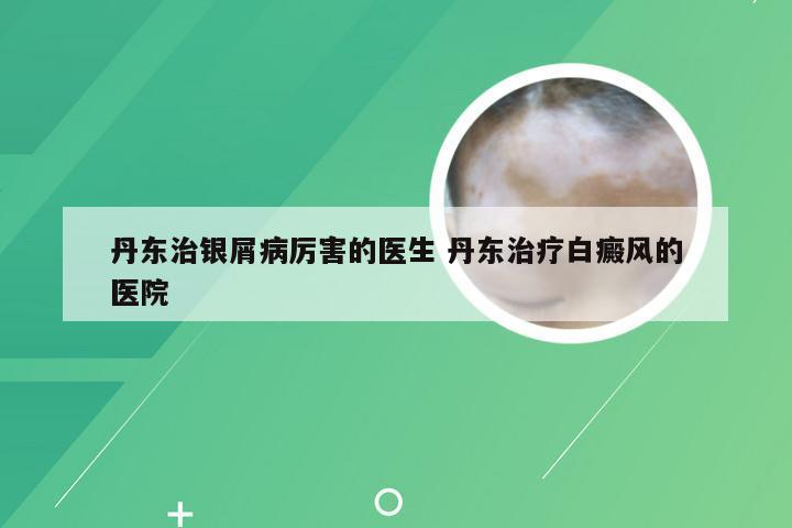 丹东治银屑病厉害的医生 丹东治疗白癜风的医院
