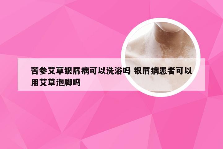 苦参艾草银屑病可以洗浴吗 银屑病患者可以用艾草泡脚吗