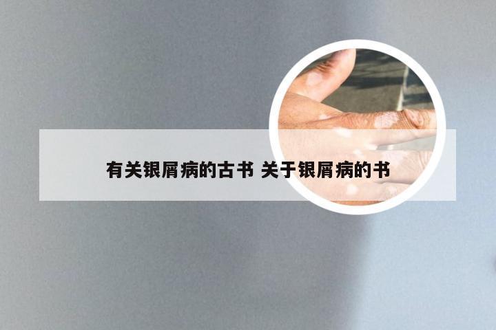 有关银屑病的古书 关于银屑病的书