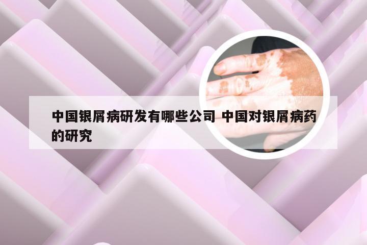 中国银屑病研发有哪些公司 中国对银屑病药的研究