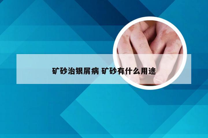 矿砂治银屑病 矿砂有什么用途