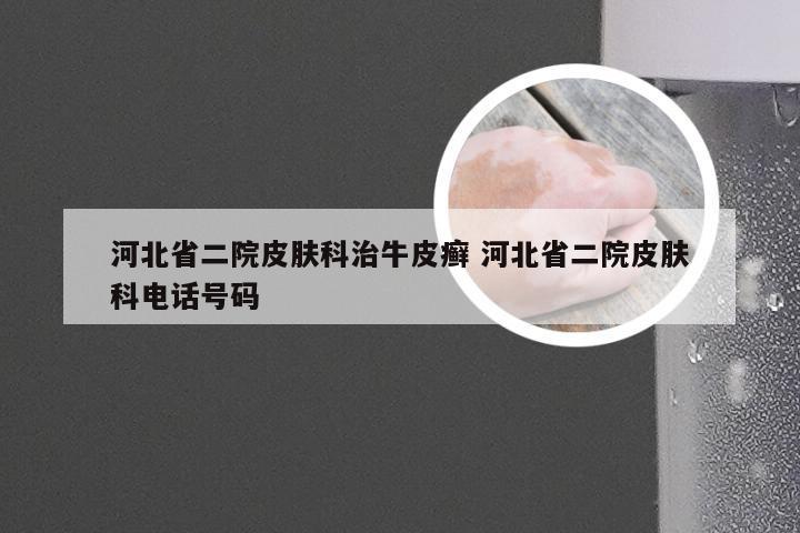 河北省二院皮肤科治牛皮癣 河北省二院皮肤科电话号码