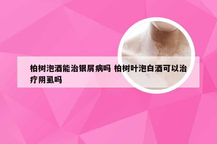 柏树泡酒能治银屑病吗 柏树叶泡白酒可以治疗阴虱吗