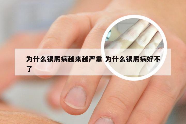为什么银屑病越来越严重 为什么银屑病好不了