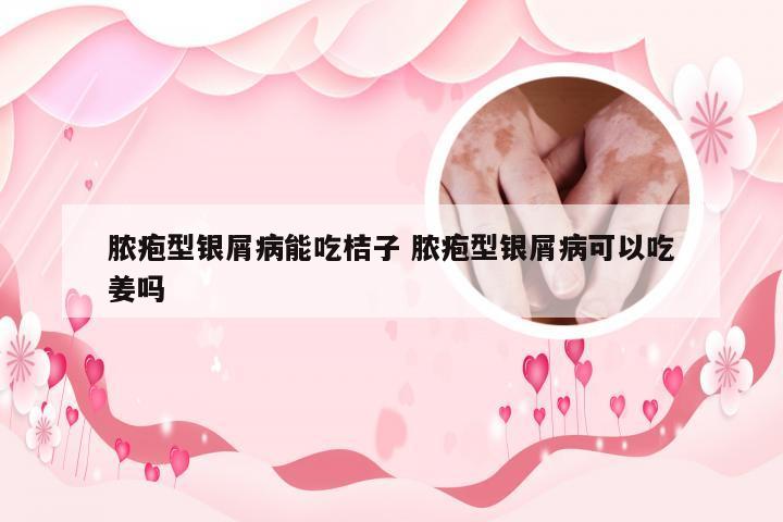 脓疱型银屑病能吃桔子 脓疱型银屑病可以吃姜吗