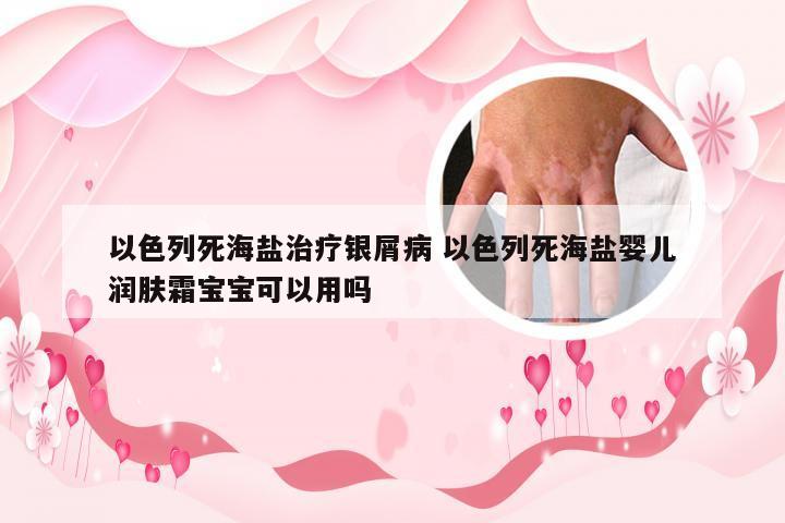 以色列死海盐治疗银屑病 以色列死海盐婴儿润肤霜宝宝可以用吗