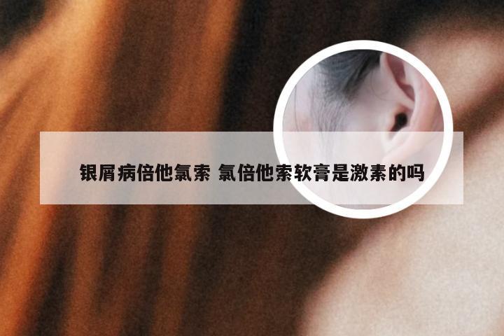 银屑病倍他氯索 氯倍他索软膏是激素的吗