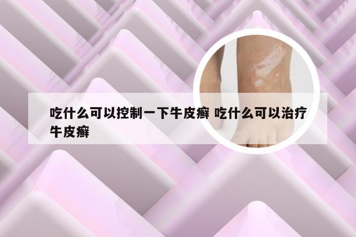 吃什么可以控制一下牛皮癣 吃什么可以治疗牛皮癣