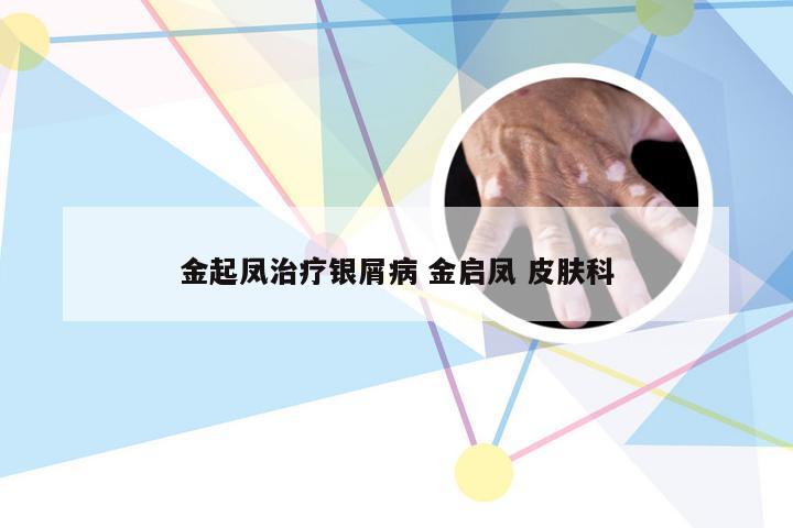 金起凤治疗银屑病 金启凤 皮肤科
