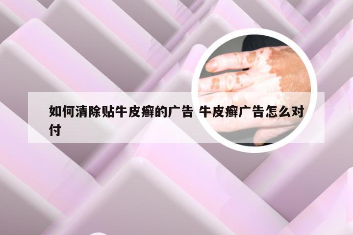 如何清除贴牛皮癣的广告 牛皮癣广告怎么对付