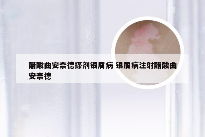 醋酸曲安奈德搽剂银屑病 银屑病注射醋酸曲安奈德