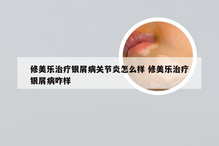 修美乐治疗银屑病关节炎怎么样 修美乐治疗银屑病咋样