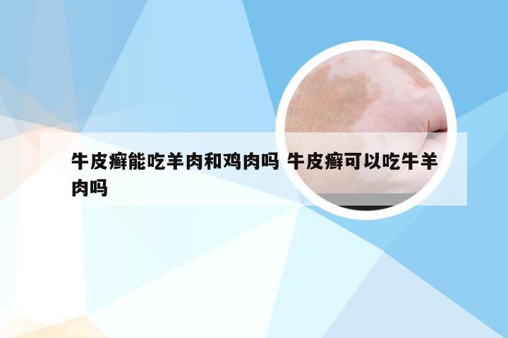 牛皮癣能吃羊肉和鸡肉吗 牛皮癣可以吃牛羊肉吗