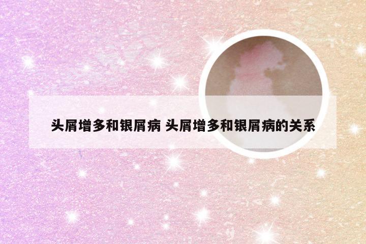 头屑增多和银屑病 头屑增多和银屑病的关系