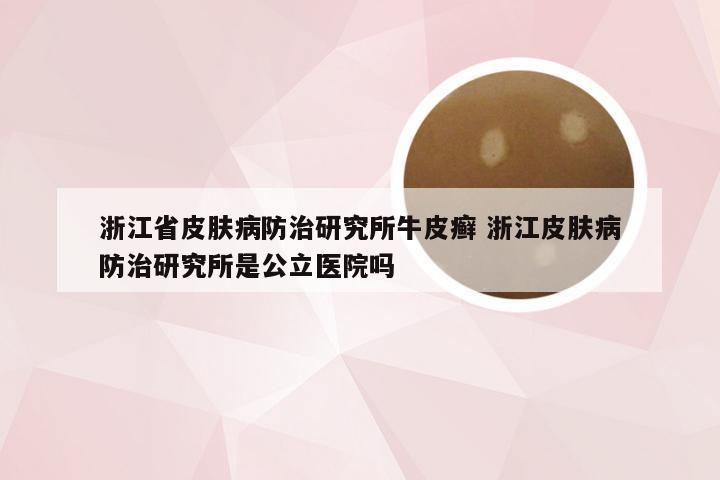 浙江省皮肤病防治研究所牛皮癣 浙江皮肤病防治研究所是公立医院吗