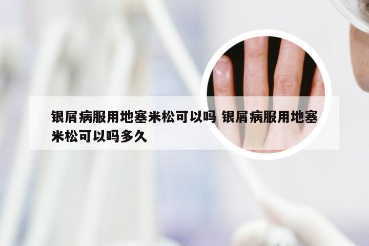 银屑病服用地塞米松可以吗 银屑病服用地塞米松可以吗多久