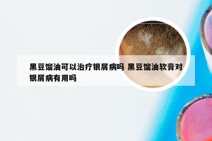 黑豆馏油可以治疗银屑病吗 黑豆馏油软膏对银屑病有用吗