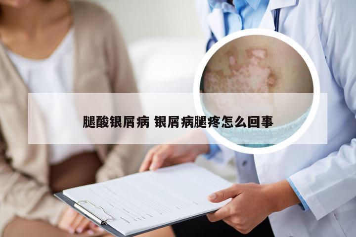 腿酸银屑病 银屑病腿疼怎么回事