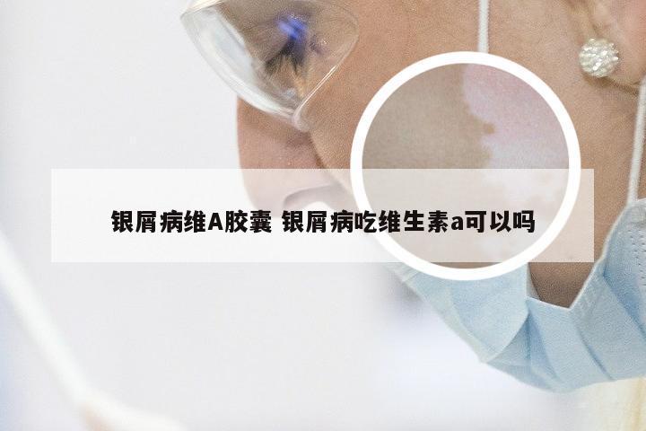银屑病维A胶囊 银屑病吃维生素a可以吗