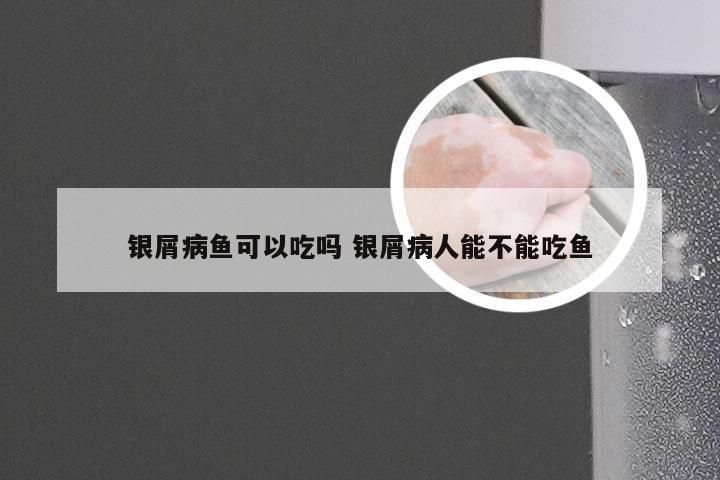 银屑病鱼可以吃吗 银屑病人能不能吃鱼