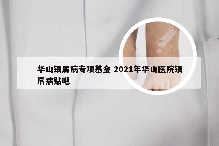 华山银屑病专项基金 2021年华山医院银屑病贴吧