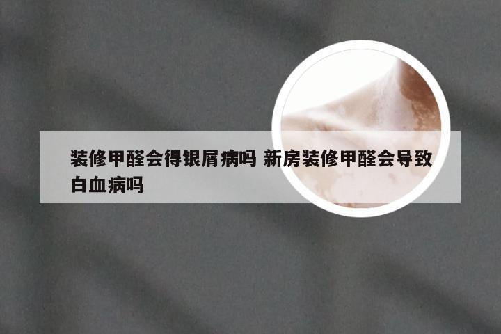 装修甲醛会得银屑病吗 新房装修甲醛会导致白血病吗