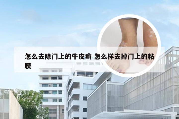 怎么去除门上的牛皮癣 怎么样去掉门上的粘膜