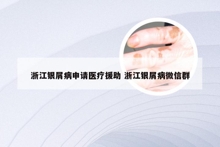 浙江银屑病申请医疗援助 浙江银屑病微信群