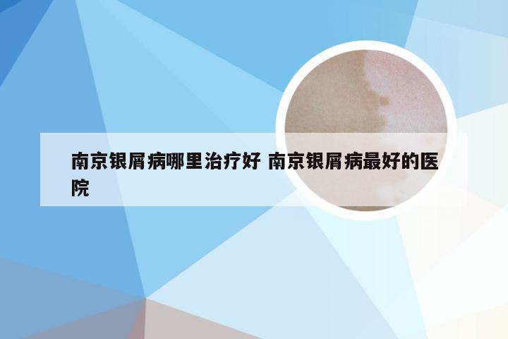 南京银屑病哪里治疗好 南京银屑病最好的医院