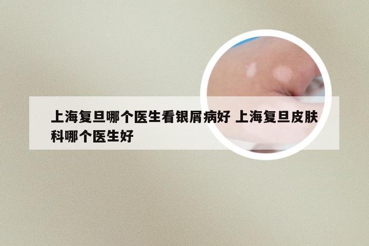 上海复旦哪个医生看银屑病好 上海复旦皮肤科哪个医生好
