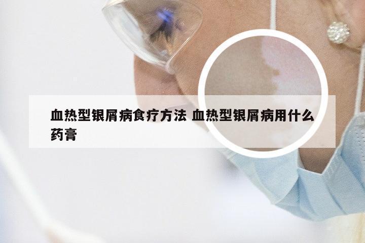 血热型银屑病食疗方法 血热型银屑病用什么药膏