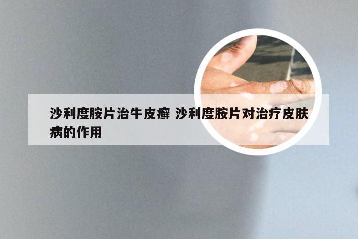 沙利度胺片治牛皮癣 沙利度胺片对治疗皮肤病的作用
