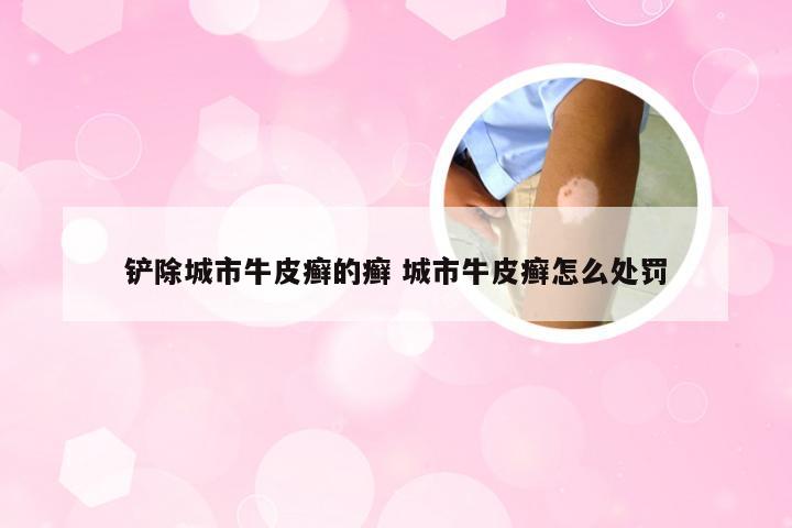 铲除城市牛皮癣的癣 城市牛皮癣怎么处罚