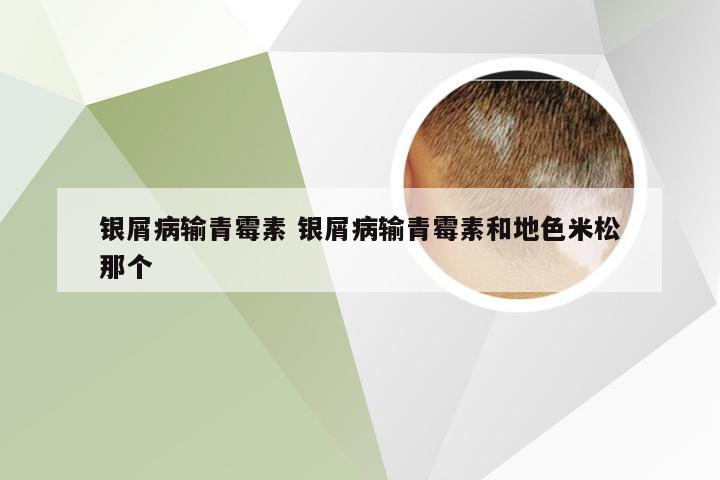银屑病输青霉素 银屑病输青霉素和地色米松那个