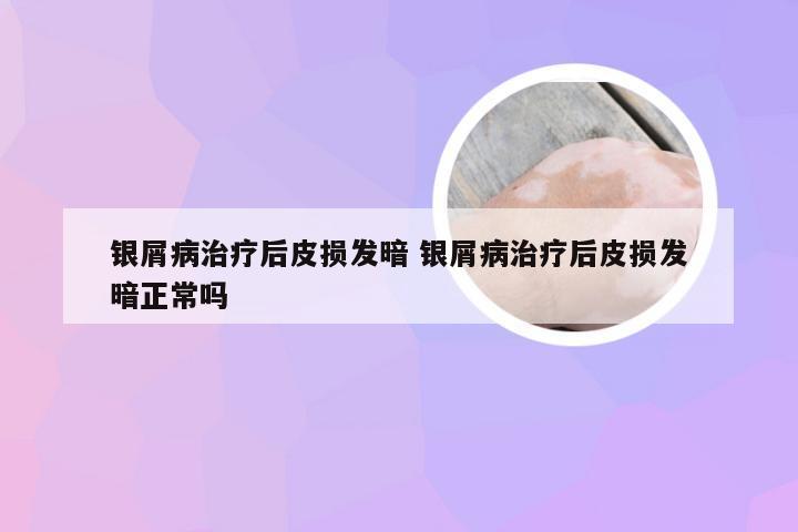 银屑病治疗后皮损发暗 银屑病治疗后皮损发暗正常吗