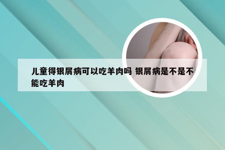 儿童得银屑病可以吃羊肉吗 银屑病是不是不能吃羊肉