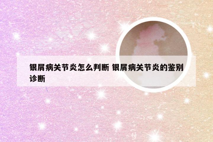 银屑病关节炎怎么判断 银屑病关节炎的鉴别诊断