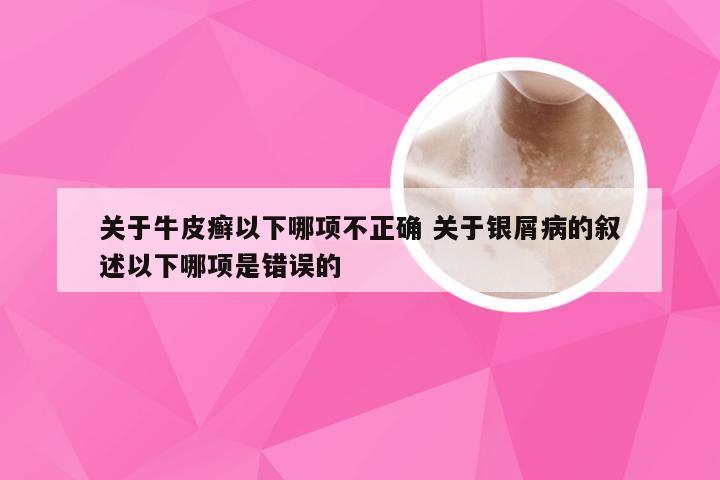 关于牛皮癣以下哪项不正确 关于银屑病的叙述以下哪项是错误的
