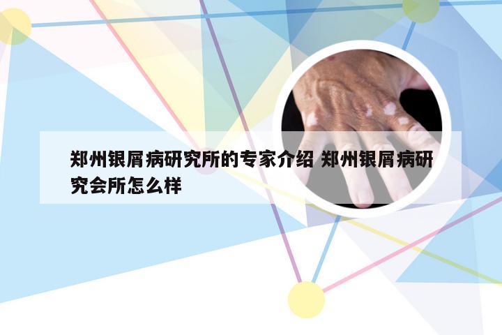 郑州银屑病研究所的专家介绍 郑州银屑病研究会所怎么样