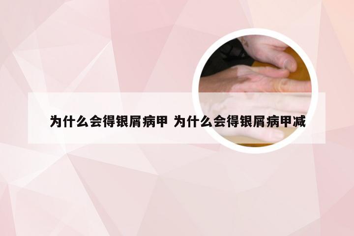 为什么会得银屑病甲 为什么会得银屑病甲减